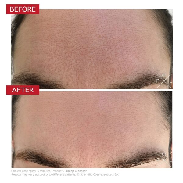 Dr LEVY 3Deep Cleanser / Fast Mask - 150ml - Image 3