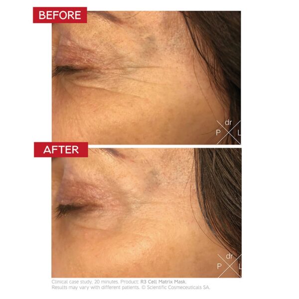 Dr LEVY R3 Cell Matrix Mask - 50ml - Image 5