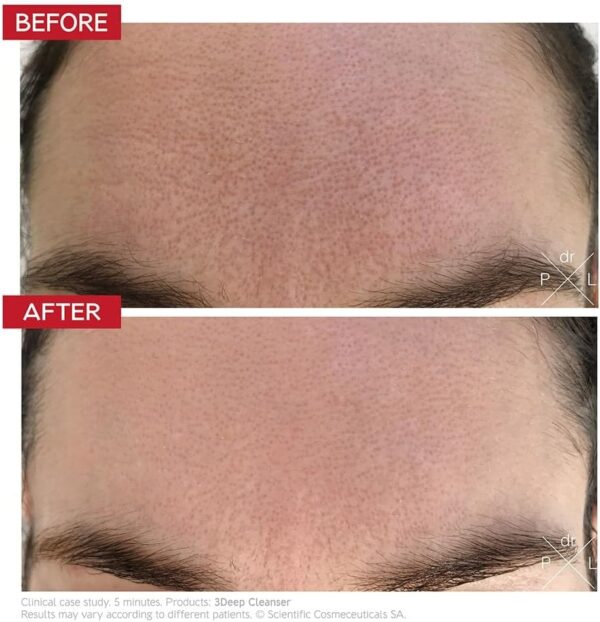 Dr. LEVY 3Deep Cell Renewal Micro-Resurfacing Cleanser, 150ml - Image 2
