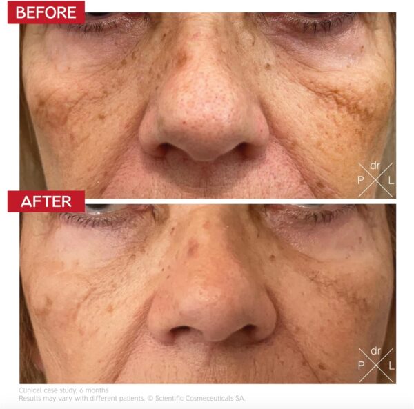 Dr. LEVY Pigment Control Drops (30 ml) | Anti-Pigmentation Complex - Image 3